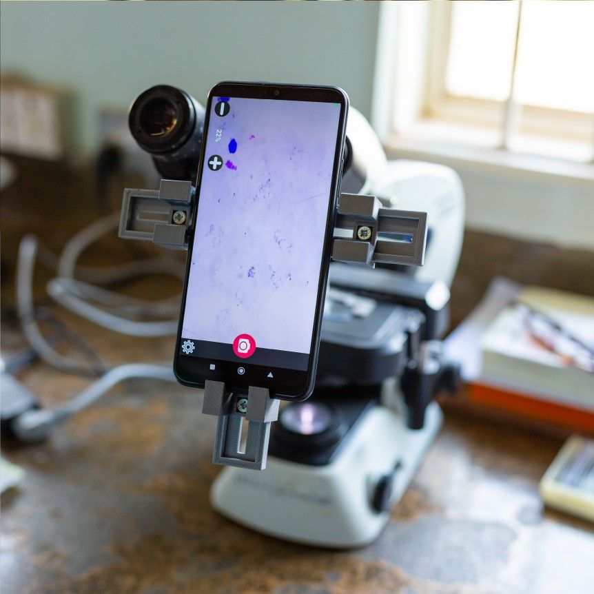 Paludisme en Ouganda, l'IA diagnostique en 90 secondes