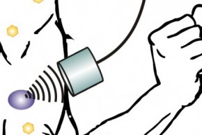 Les ultrasons et les nanoparticules pourraient améliorer le traitement des diabétiques